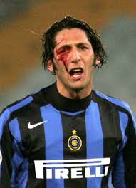 materazzi